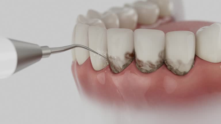 Trusted Tooth Extraction service in Trowbridge Park, MI - Dentist Open Now